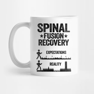Bionic Spine Surgery Lumber Spinal Fusion Back Recovery Mug